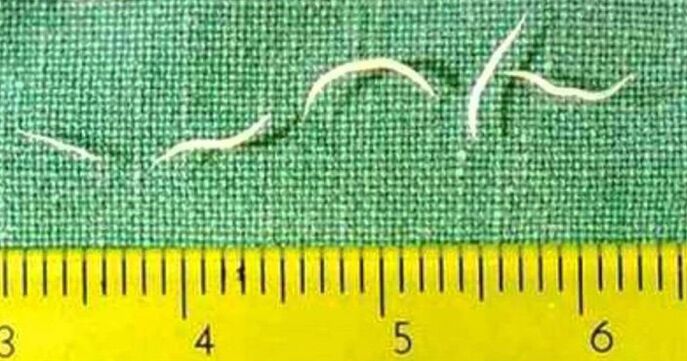 Pinworms mangrupakeun jenis cacing paling umum di barudak ngora. 