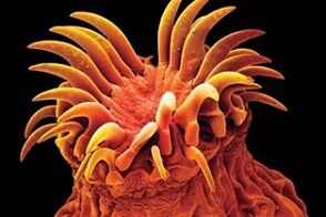 Parasit trematis dina manusa