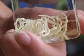 parasit tina awak manusa