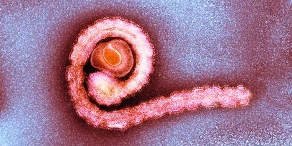 tapeworm dwarf dina awak manusa